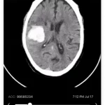 Viz Recruit Patient Recruitment Software 1 Viz Recruit Patient Recruitment Software 1